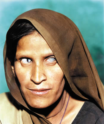 image from the exhibition bhopal; © Andy Moxon